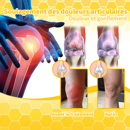 Crème anti-douleur au venin d'abeille pour l'arthrite ArthroFree™