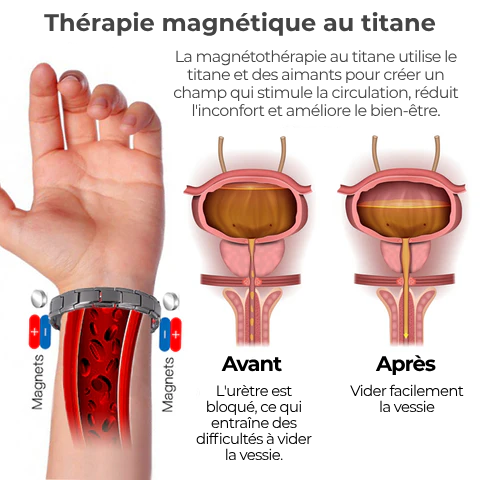 Bracelet magnétique en titane pour le bien-être de la prostate Oveallgo™